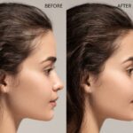 JEM FALL PREVENTION LOTION - Image 6